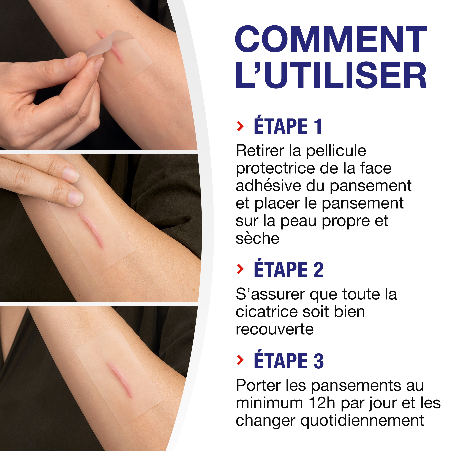 Application des pansements Elastoplast