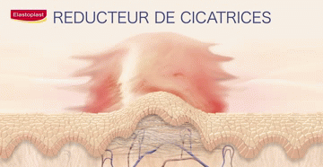 Les effets du pansement Elastopast cicatrisant