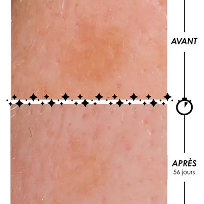 Résultats Garancia Eclair de Lune Crème Lactée Anti-Taches