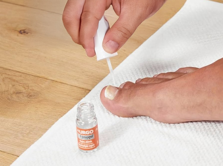 Utilisation Urgo Filmogel Ongles Abimes