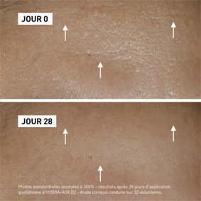 résultat sérum filorga