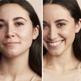 illustration produit avec/sans