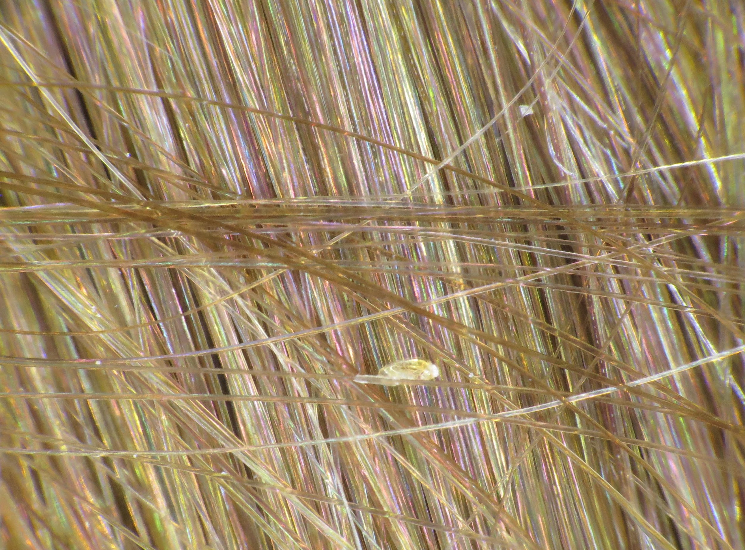Lente accrochée aux cheveux