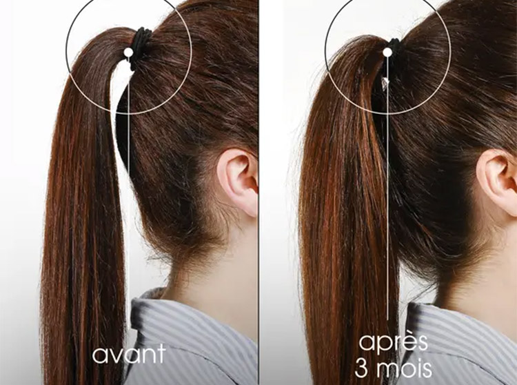 Résultats avant/après Traitement Fortifiant Intense Anti-Chute Quinine Klorane