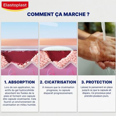 Fonctionnement Pansement Hydrocolloide Elastoplast