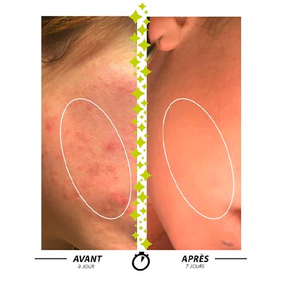 Résultat Sulfureuse pate du marabout
