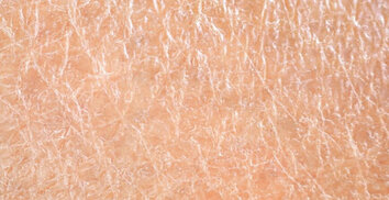 Le gommage Biocorps corrige la rugosité de la peau